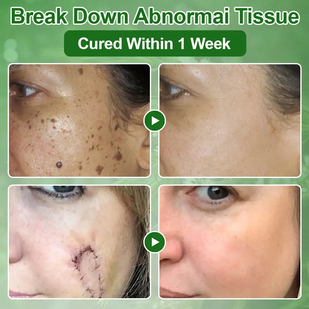 ๐๐๐ ๐๐ซ๐๐ ๐๐ข๐ฅ ๐๐ค๐ข๐ง ๐๐ซ๐๐๐ญ๐ฆ๐๐ง๐ญ ๐๐ซ๐๐๐ฆ - Image 5