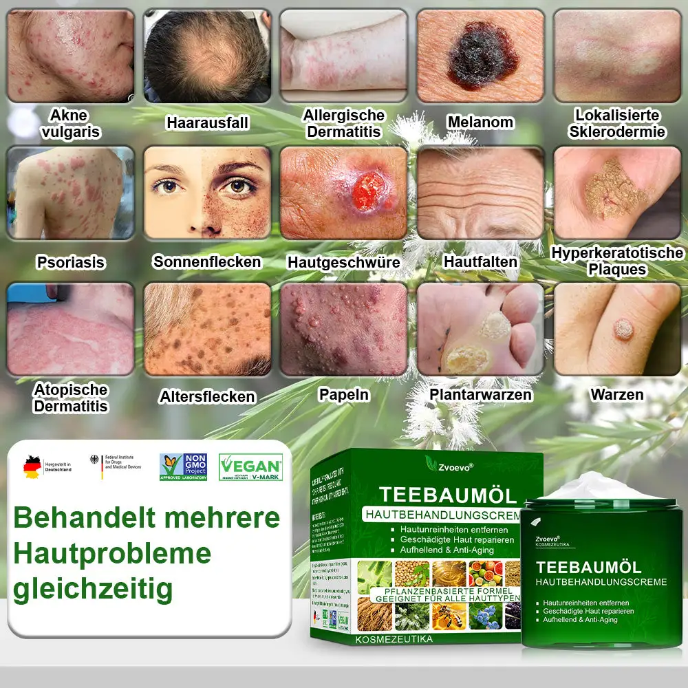 ๐๐๐๐๐๐ฎ๐ฆ๐จฬ๐ฅ ๐๐๐ฎ๐ญ๐ฉ๐๐ฅ๐๐ ๐๐๐๐ก๐๐ง๐๐ฅ๐ฎ๐ง๐ ๐๐ซ๐๐ฆ๐ - Image 2