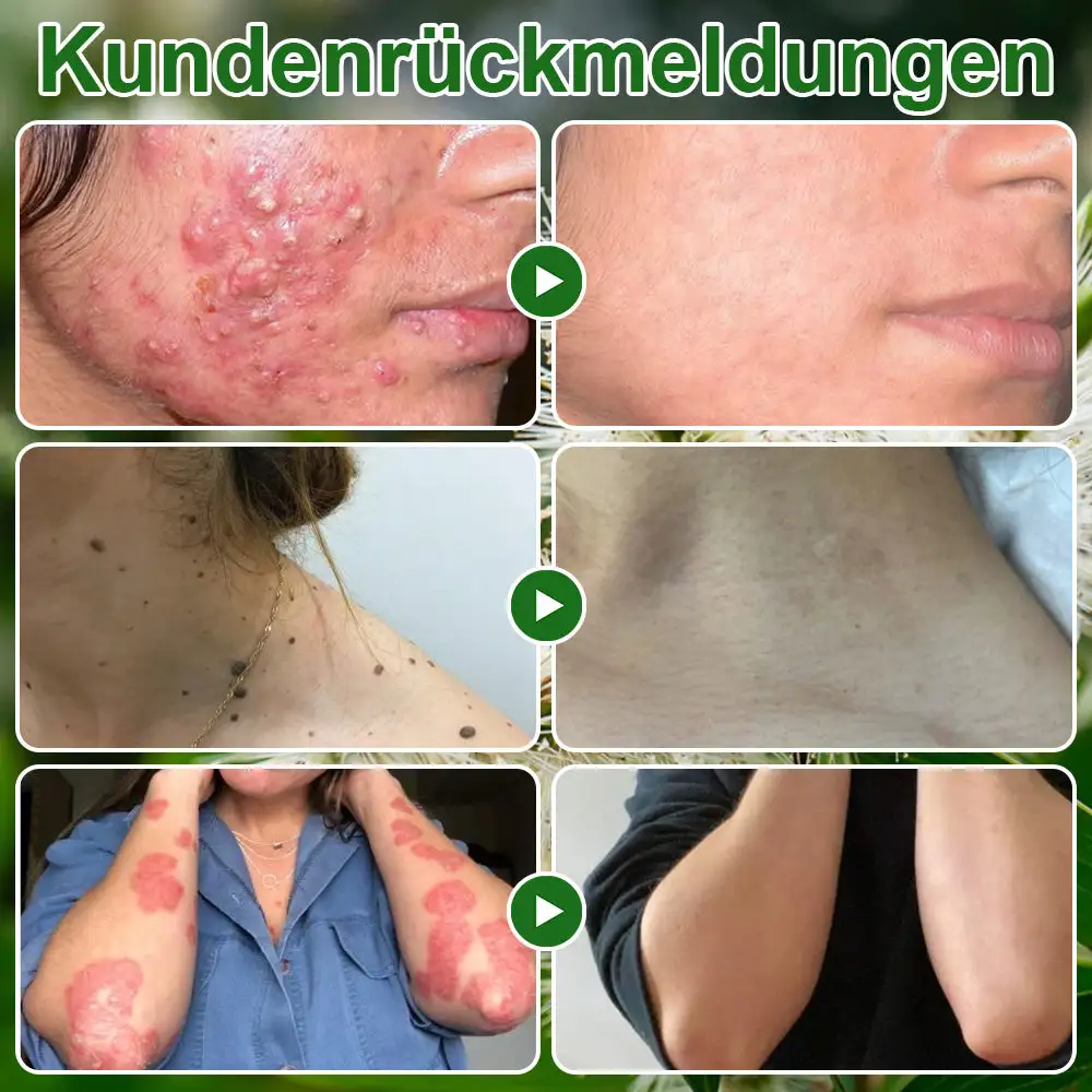 ๐๐๐๐๐๐ฎ๐ฆ๐จฬ๐ฅ ๐๐๐ฎ๐ญ๐ฉ๐๐ฅ๐๐ ๐๐๐๐ก๐๐ง๐๐ฅ๐ฎ๐ง๐ ๐๐ซ๐๐ฆ๐ - Image 3