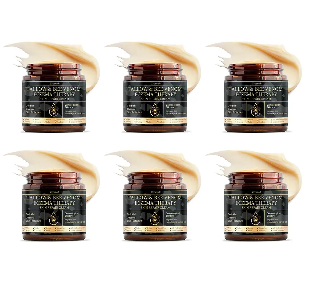 ๐๐ฌ๐จ๐ซ๐ข๐๐ฌ๐ข๐ฌ & ๐๐๐ณ๐๐ฆ๐ ๐๐๐ฅ๐ข๐๐ ๐๐ซ๐๐๐ฆ - Image 13