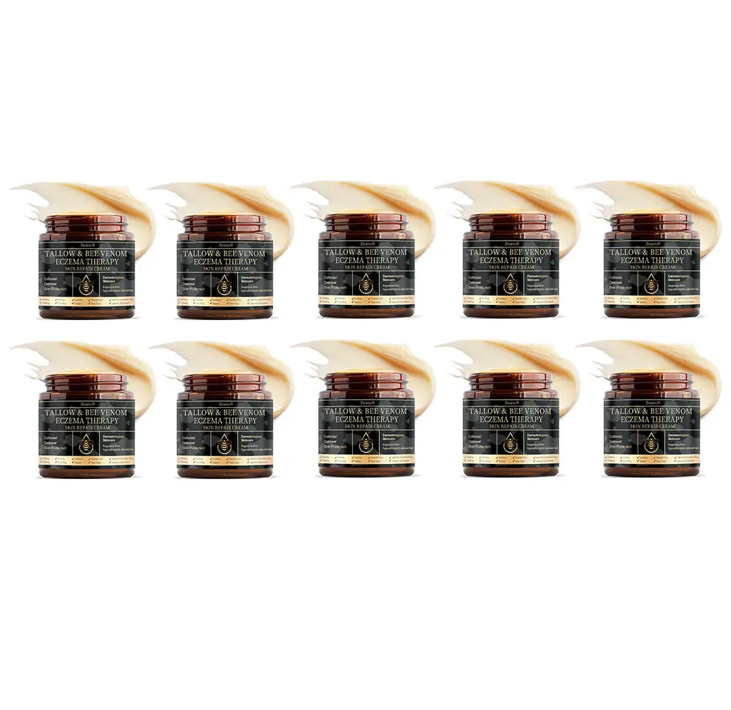 ๐๐ฌ๐จ๐ซ๐ข๐๐ฌ๐ข๐ฌ & ๐๐๐ณ๐๐ฆ๐ ๐๐๐ฅ๐ข๐๐ ๐๐ซ๐๐๐ฆ - Image 14