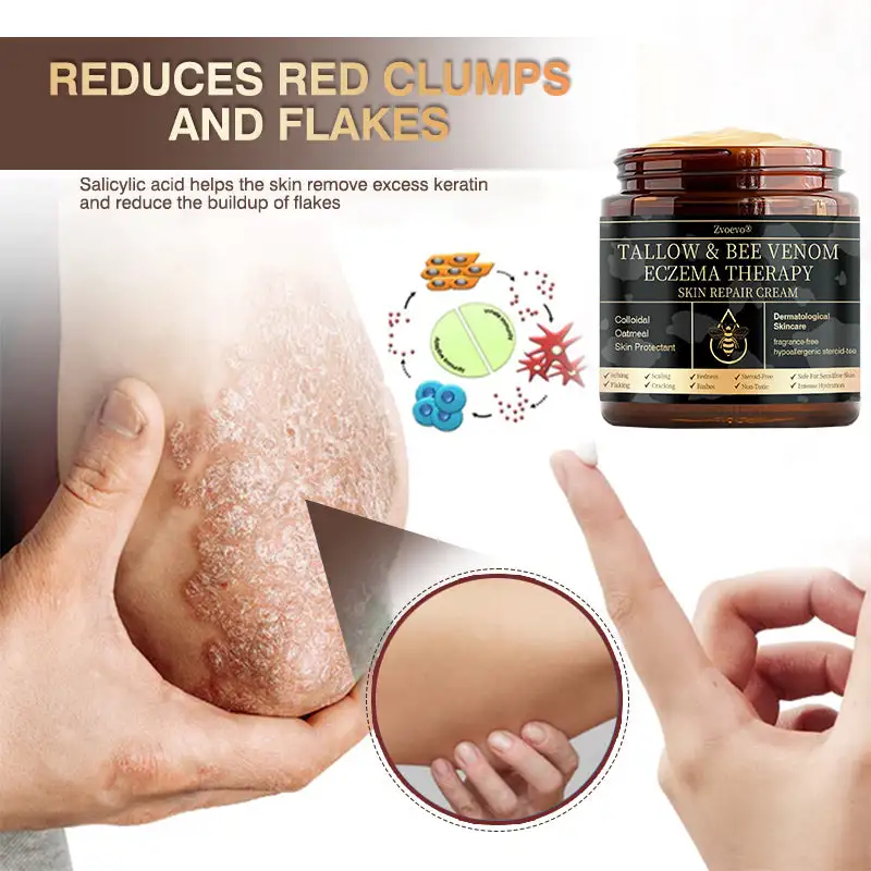 ๐๐ฌ๐จ๐ซ๐ข๐๐ฌ๐ข๐ฌ & ๐๐๐ณ๐๐ฆ๐ ๐๐๐ฅ๐ข๐๐ ๐๐ซ๐๐๐ฆ - Image 3