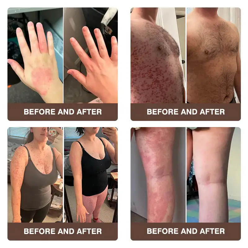 ๐๐ฌ๐จ๐ซ๐ข๐๐ฌ๐ข๐ฌ & ๐๐๐ณ๐๐ฆ๐ ๐๐๐ฅ๐ข๐๐ ๐๐ซ๐๐๐ฆ - Image 5