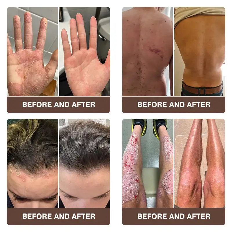 ๐๐ฌ๐จ๐ซ๐ข๐๐ฌ๐ข๐ฌ & ๐๐๐ณ๐๐ฆ๐ ๐๐๐ฅ๐ข๐๐ ๐๐ซ๐๐๐ฆ - Image 6