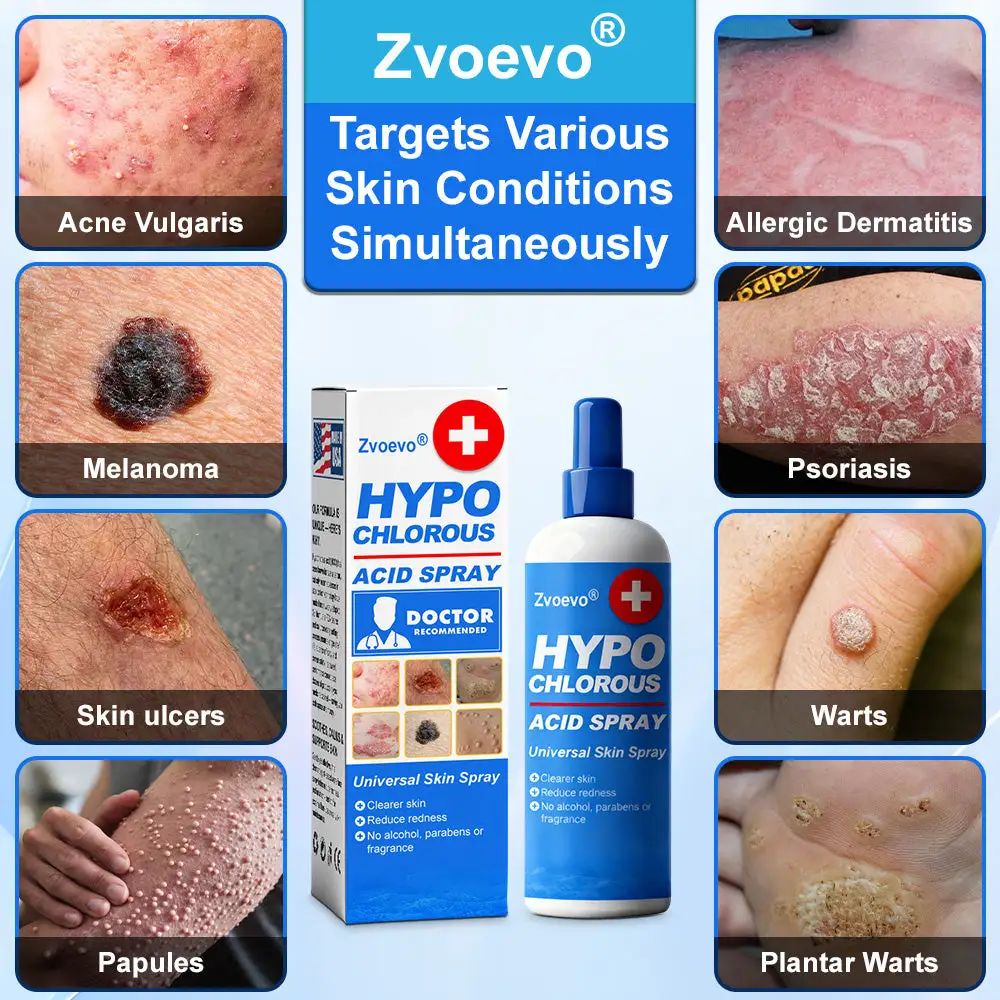 ๐๐ฒ๐ฉ๐จ๐๐ก๐ฅ๐จ๐ซ๐จ๐ฎ๐ฌ ๐๐๐ข๐ ๐๐ฉ๐ซ๐๐ฒ - Image 2