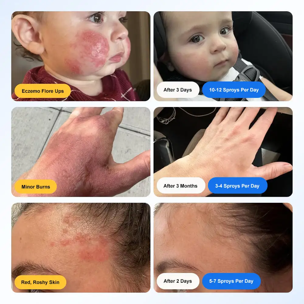 ๐๐ฒ๐ฉ๐จ๐๐ก๐ฅ๐จ๐ซ๐จ๐ฎ๐ฌ ๐๐๐ข๐ ๐๐ฉ๐ซ๐๐ฒ - Image 8