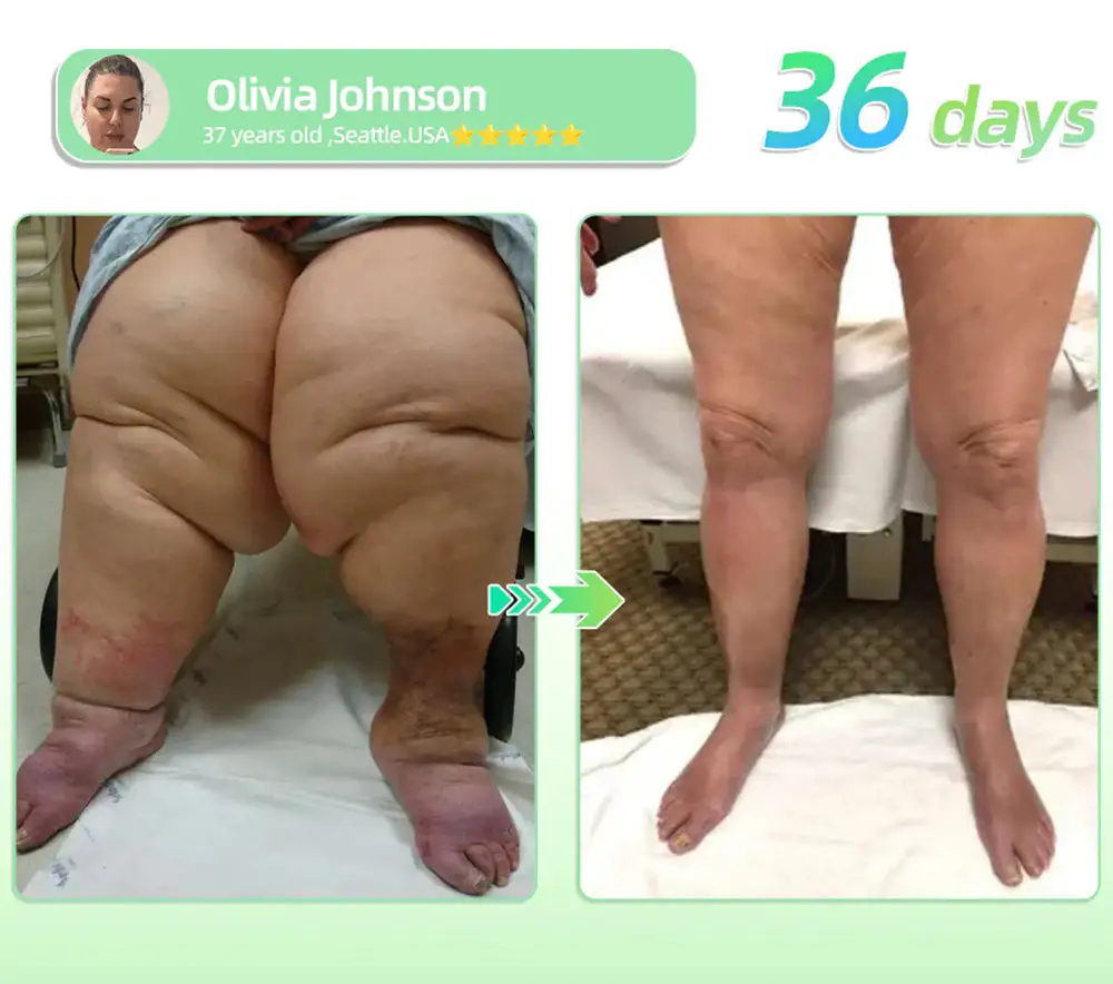 ๐บ๐ฐ๐ฟ ๐ฐ๐ต-๐ถ๐ต๐ฌ ๐ฏ๐๐๐๐๐ ๐บ๐๐๐๐๐๐๐ ๐ถ๐๐๐ ๐ณ๐๐๐๐๐
- Image 12