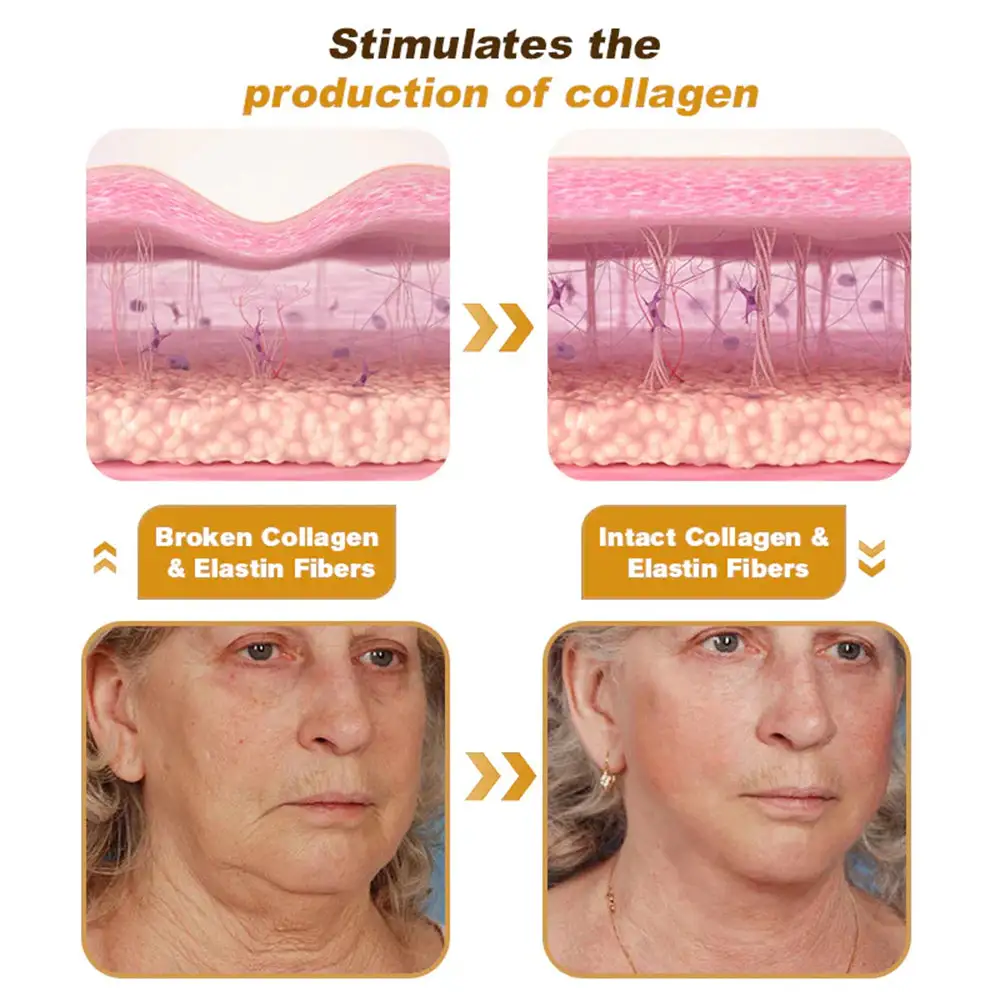 ๐บ๐ฐ๐ฟ ๐ฐ๐ต-๐ถ๐ต๐ฌ ๐ฏ๐๐๐๐๐ ๐บ๐๐๐๐๐๐๐ ๐ถ๐๐๐ ๐ณ๐๐๐๐๐
- Image 15