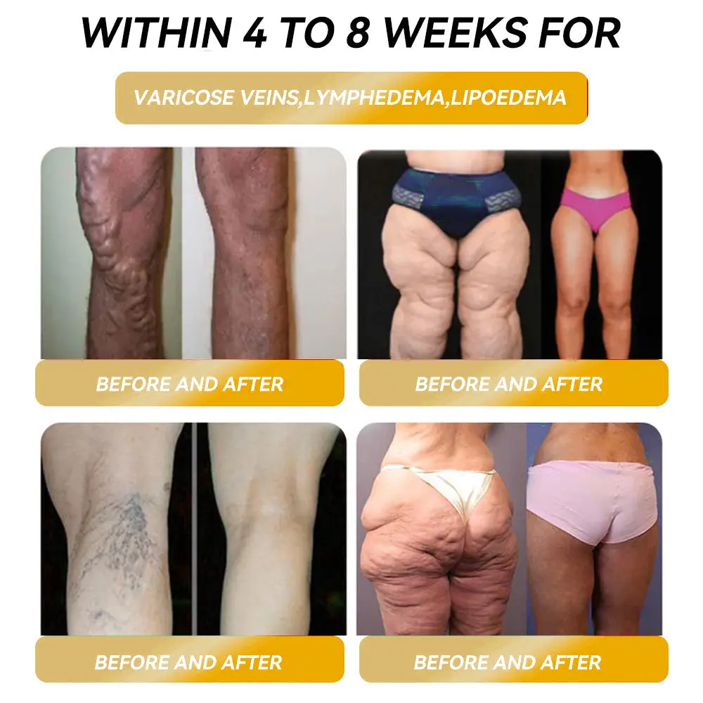 ๐๐๐ ๐ง๐๐ญ๐ข๐ ๐๐ง๐๐ซ๐ ๐ฒ ๐๐-๐๐ญ๐จ๐ง๐ ๐๐๐ฉ๐ฅ๐ ๐๐๐ซ๐ซ๐ข๐ง๐ ๐ฌ - Image 2