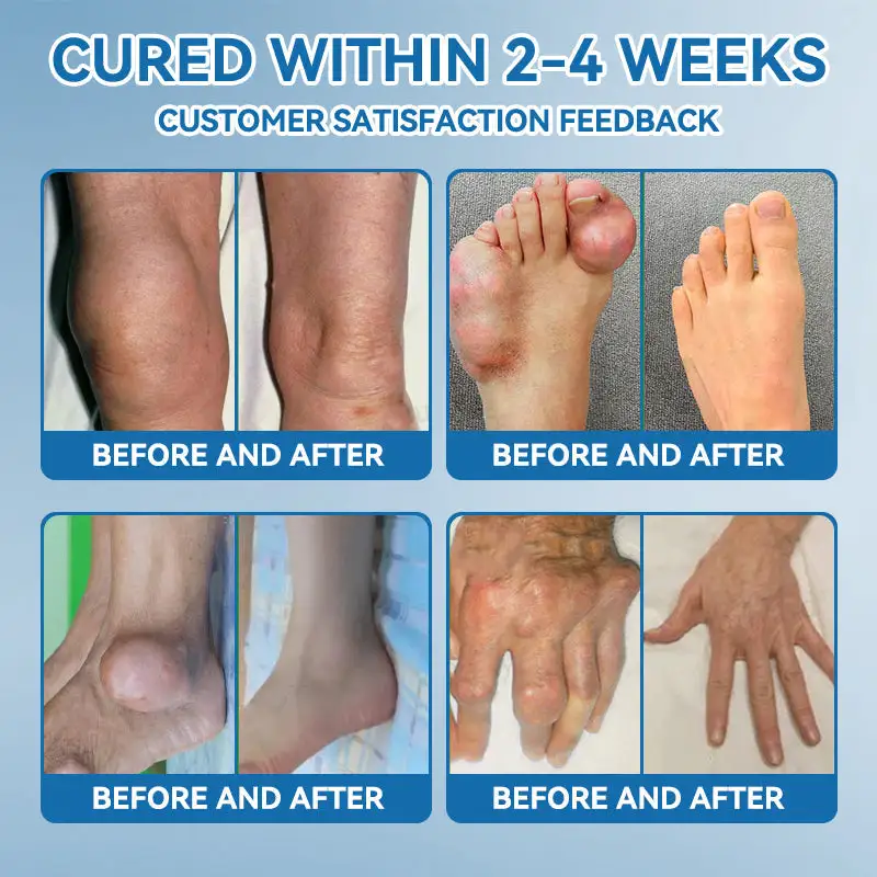 ๐๐๐-๐๐๐ ๐๐จ๐ข๐ง๐ญ ๐๐๐๐ฅ๐ข๐ง๐ ๐๐ซ๐๐๐ฆ - Image 17