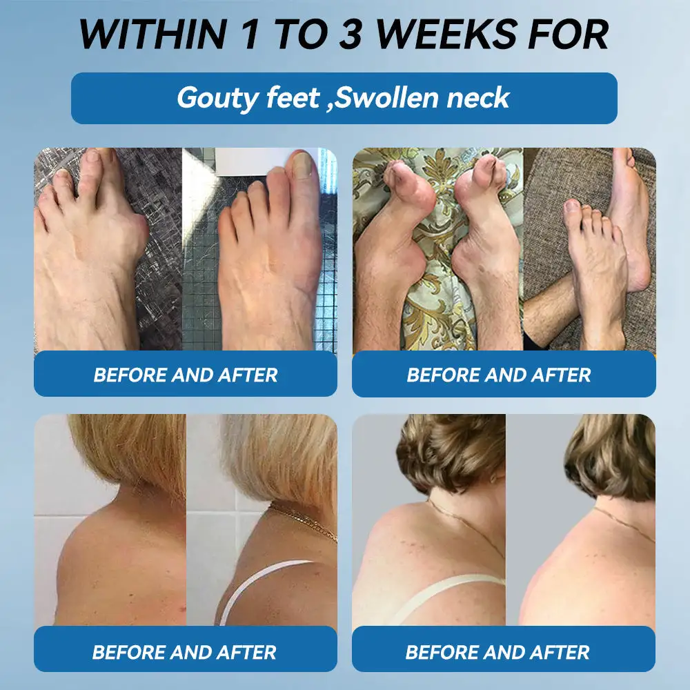 ๐๐๐-๐๐๐ ๐๐จ๐ข๐ง๐ญ ๐๐๐๐ฅ๐ข๐ง๐ ๐๐ซ๐๐๐ฆ - Image 3