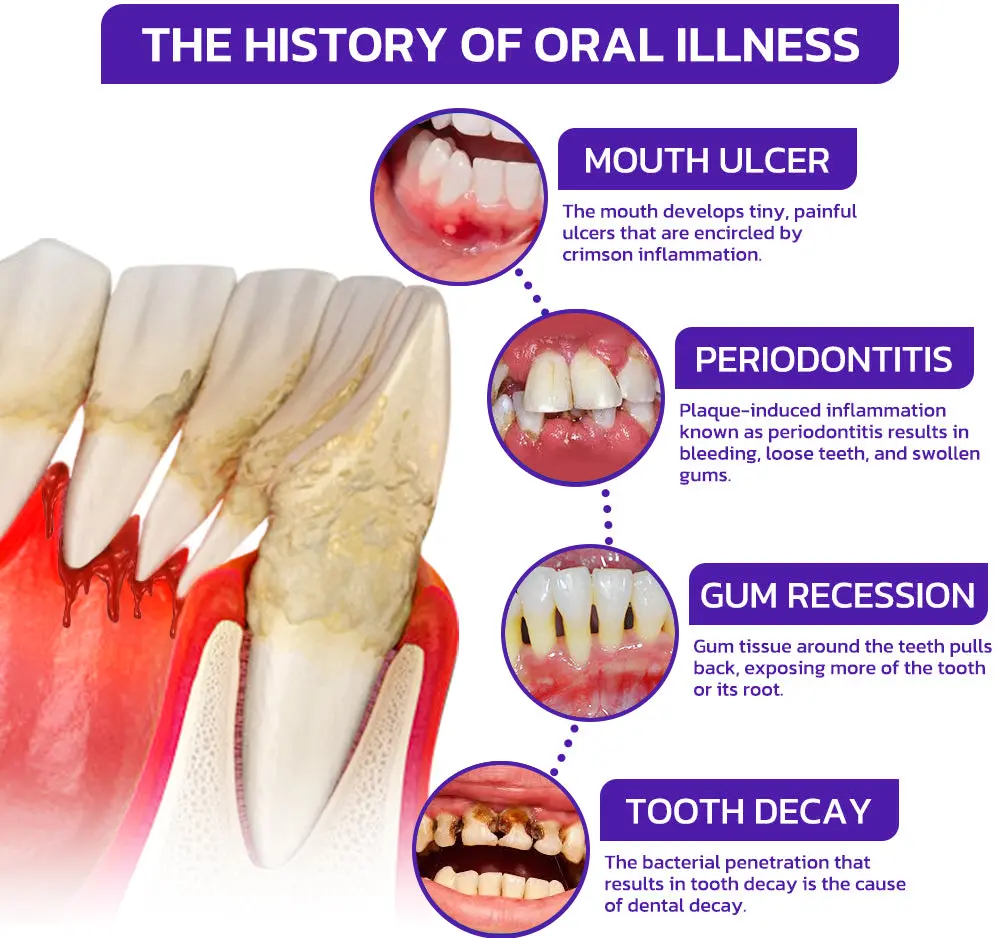 VioGloss Bee Venom Dental Therapy Oral Power - Image 5