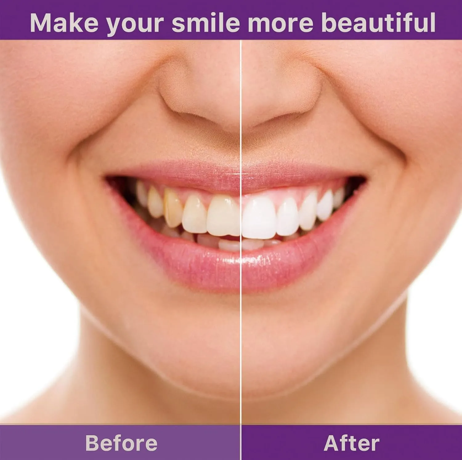 V36 Whitening Strips – Professional Teeth Whitening at Home - Image 5