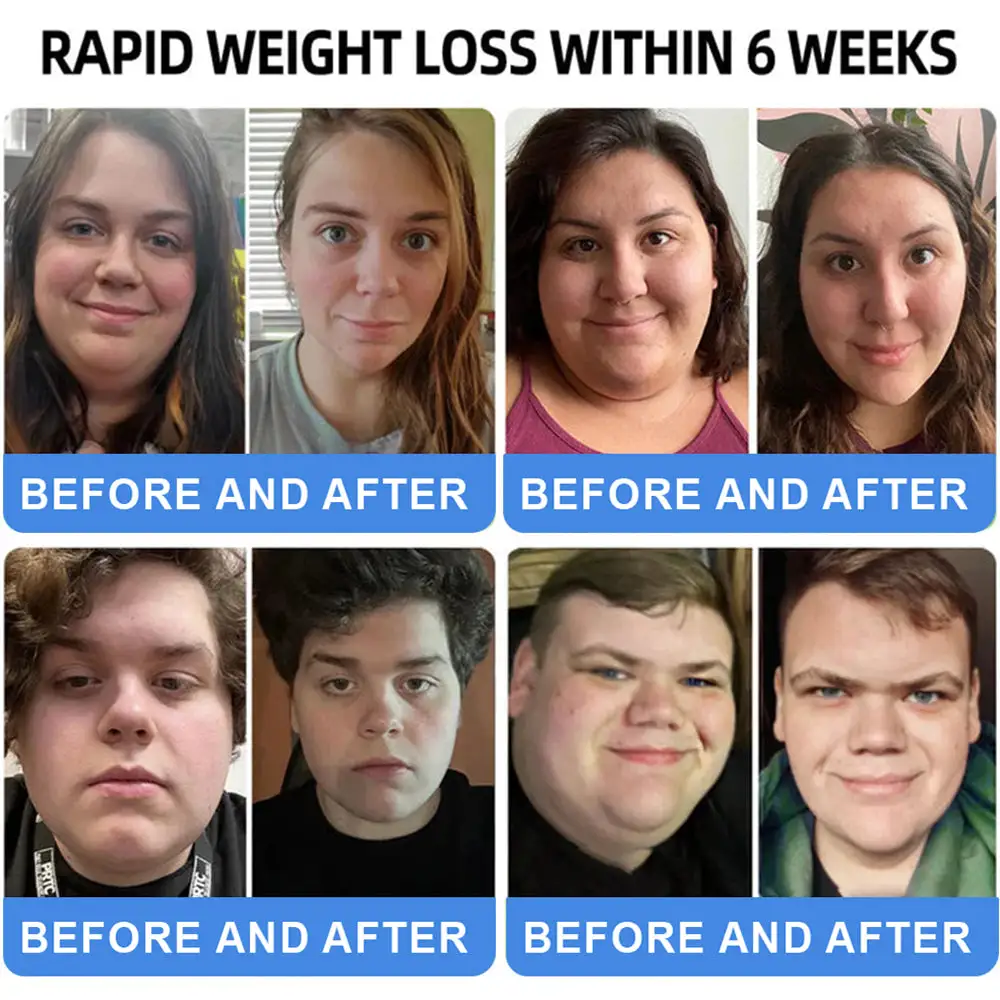 ๐๐๐+ ๐-๐ข๐ง-๐ ๐๐๐๐ฅ๐ญ๐ก ๐๐ฎ๐ฉ๐ฉ๐จ๐ซ๐ญ ๐๐ข๐ช๐ฎ๐ข๐ ๐๐ซ๐จ๐ฉ๐ฌ - Image 11