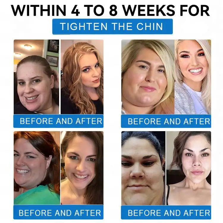 Nano-Microcrystal Patch: Tirzepatide + Collagen Dual Action for Fat Loss, Skin Tightening, and Sugar Control - Image 16