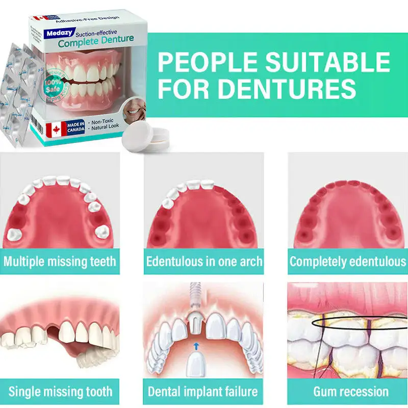 Suction-fit Complete Denture - Image 4