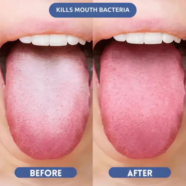 Probiotic Oral Mist - Image 8