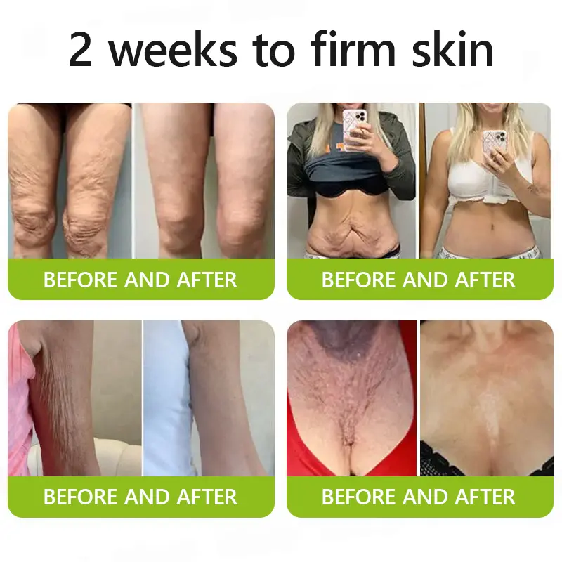 BOTOX & VITA A RETINOL SHOT Wrinkle Lift Tightening Cream - Image 6