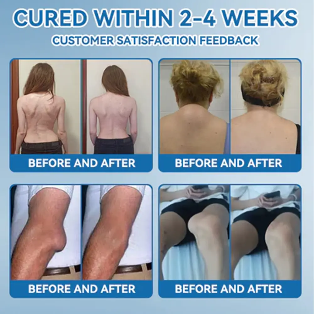 𝗕𝖯𝖢-𝟏𝟓𝟕 Joint Healing Cream - Image 6