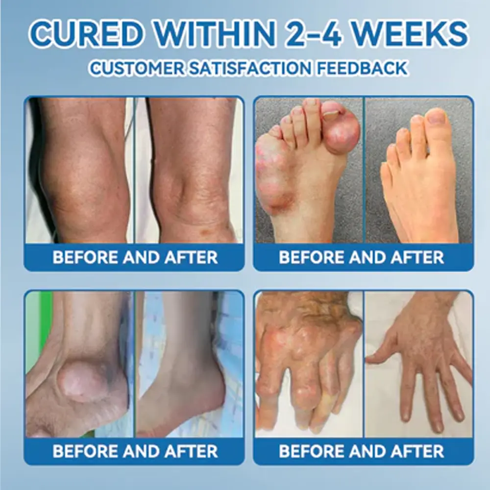 𝗕𝖯𝖢-𝟏𝟓𝟕 Joint Healing Cream - Image 7