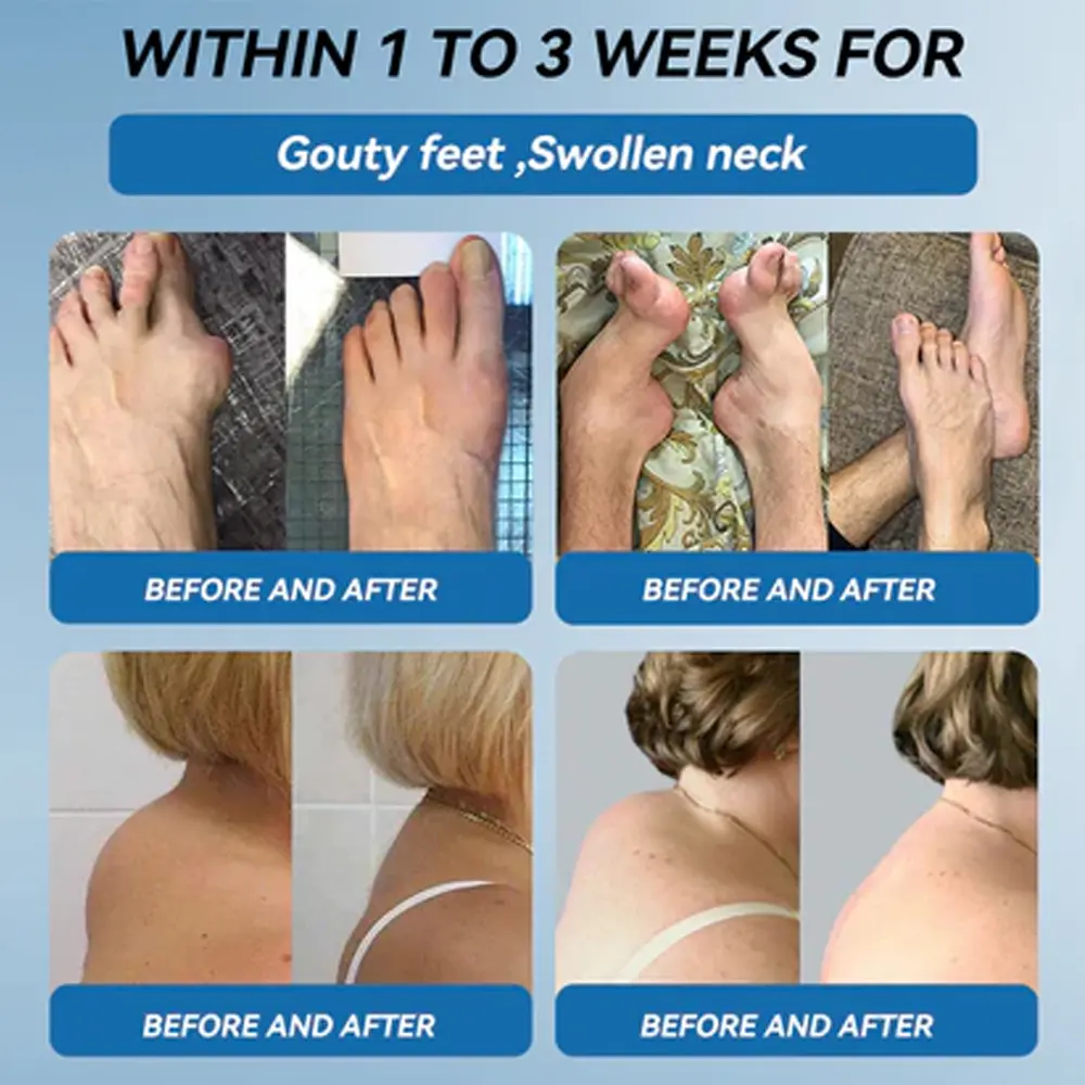 𝗕𝖯𝖢-𝟏𝟓𝟕 Joint Healing Cream - Image 2