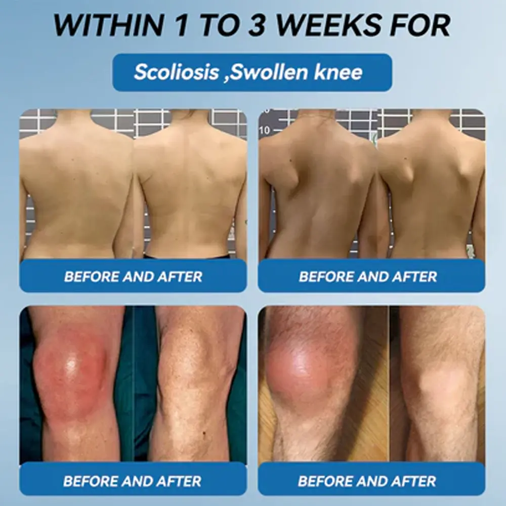 𝗕𝖯𝖢-𝟏𝟓𝟕 Joint Healing Cream - Image 3