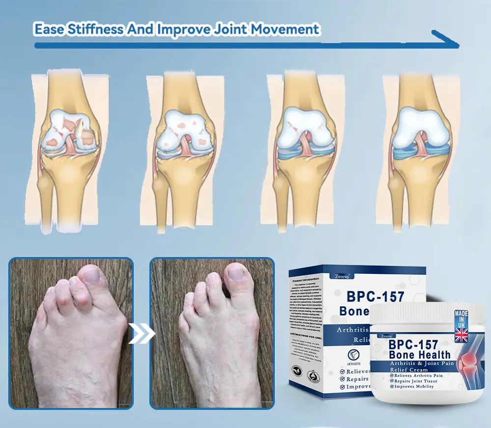 𝗕𝖯𝖢-𝟏𝟓𝟕 Joint Healing Cream - Image 5