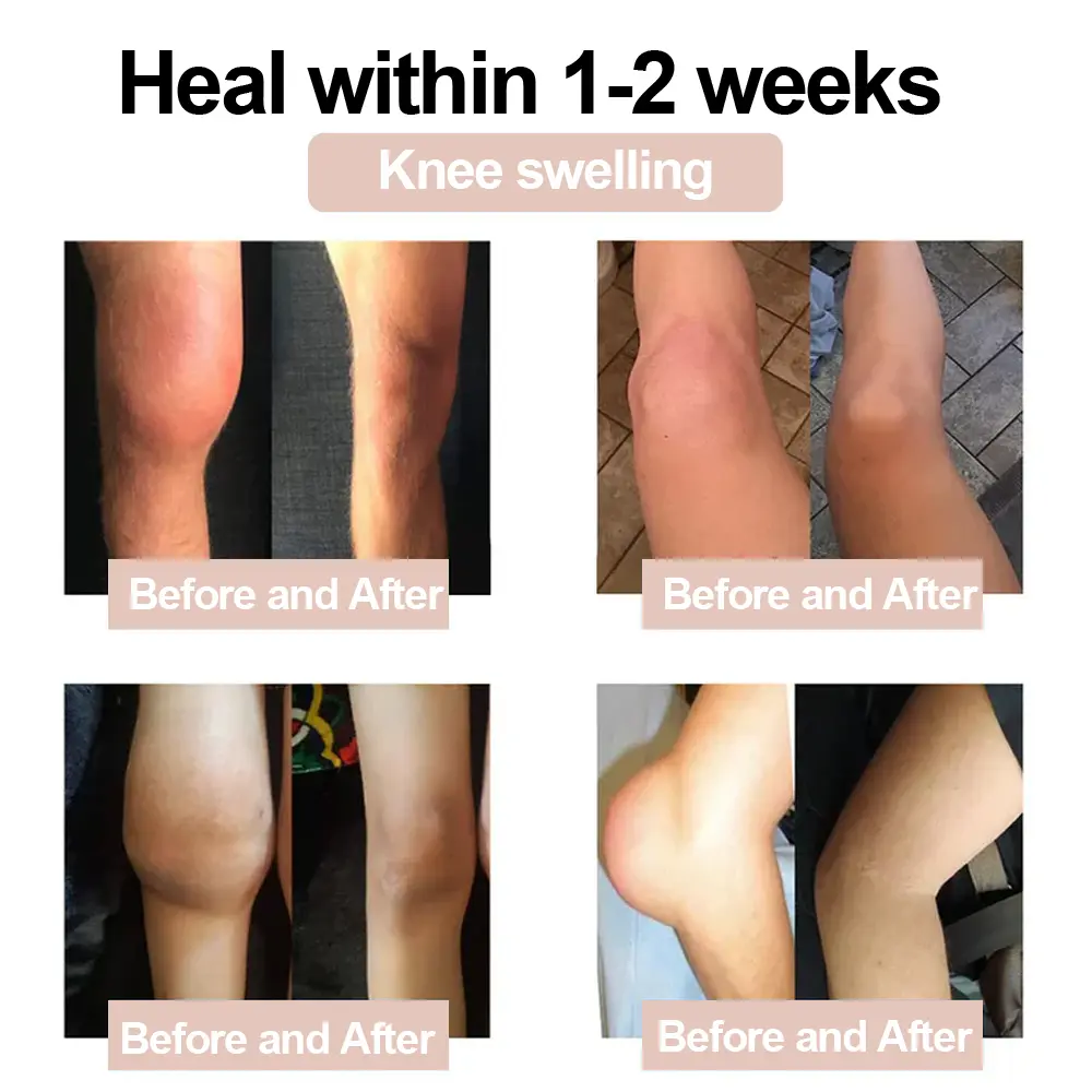 Magnesium Glycinate Joint Repair Cream - Image 5