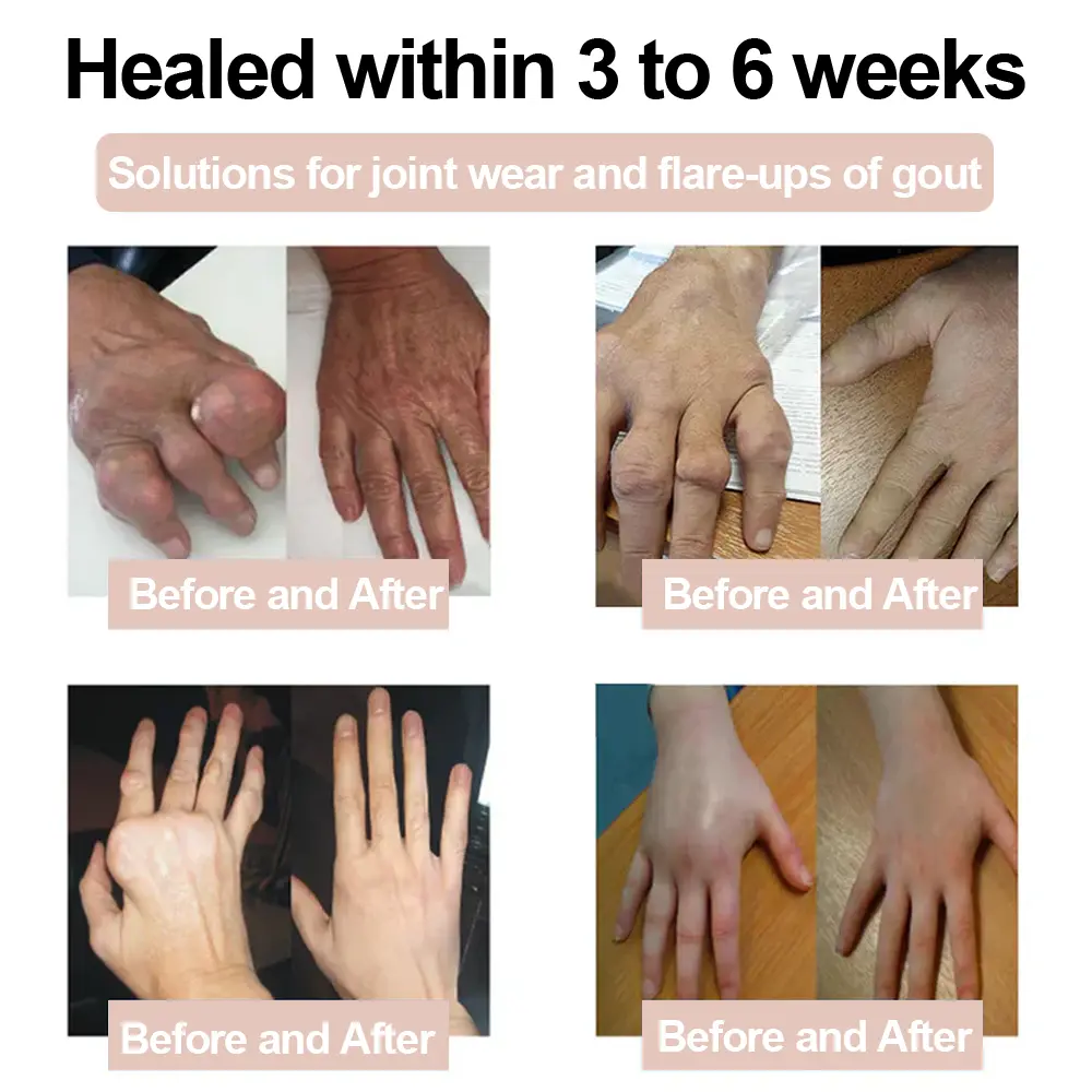 Magnesium Glycinate Joint Repair Cream - Image 6