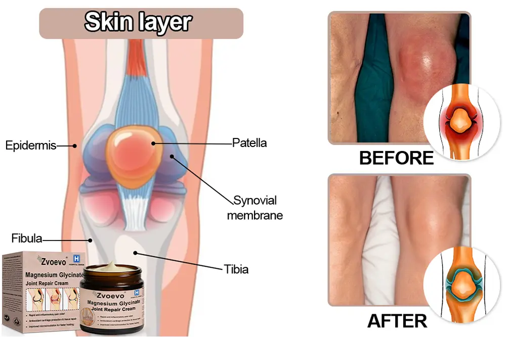 Magnesium Glycinate Joint Repair Cream - Image 9