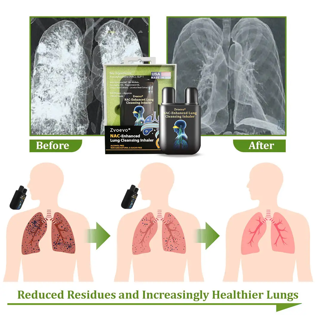 NAC-Enhanced Lung Cleansing Inhaler - Image 6