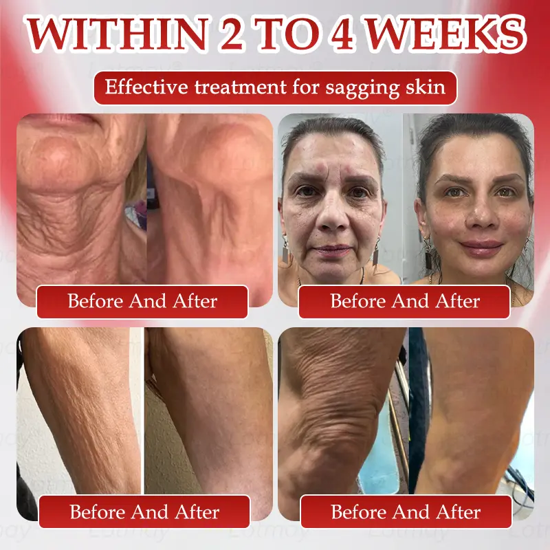 ๐ก๐ ๐ญ N๐ ๐ณ+ ๐ฑ๐๐s๐ F๐๐mi๐g & A๐๐i-๐บ๐๐๐๐ ๐ฎ๐๐l Li๐พ๐๐ถd - Image 2