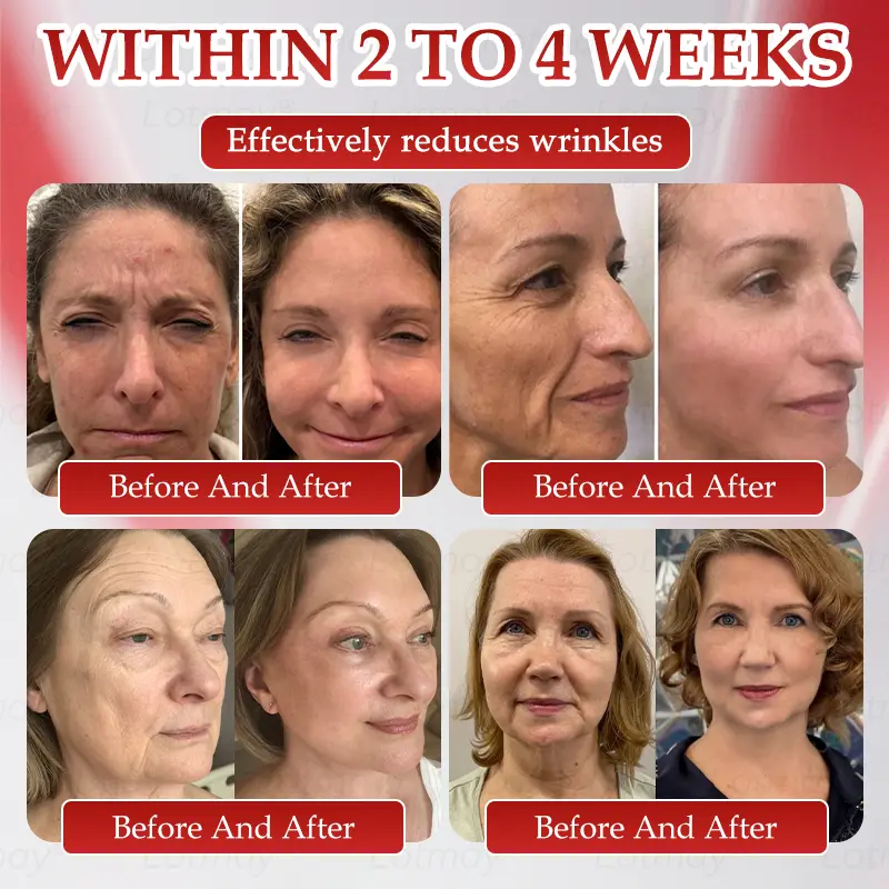 ๐ก๐ ๐ญ N๐ ๐ณ+ ๐ฑ๐๐s๐ F๐๐mi๐g & A๐๐i-๐บ๐๐๐๐ ๐ฎ๐๐l Li๐พ๐๐ถd - Image 3