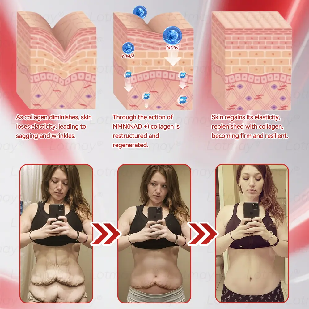 ๐ก๐ ๐ญ N๐ ๐ณ+ ๐ฑ๐๐s๐ F๐๐mi๐g & A๐๐i-๐บ๐๐๐๐ ๐ฎ๐๐l Li๐พ๐๐ถd - Image 5