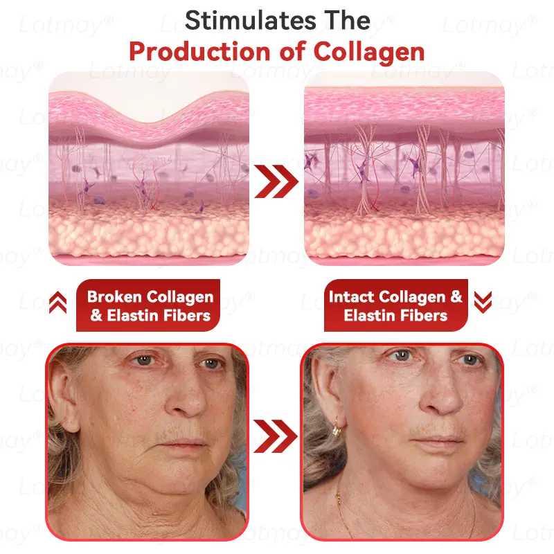 ๐ก๐ ๐ญ N๐ ๐ณ+ ๐ฑ๐๐s๐ F๐๐mi๐g & A๐๐i-๐บ๐๐๐๐ ๐ฎ๐๐l Li๐พ๐๐ถd - Image 8