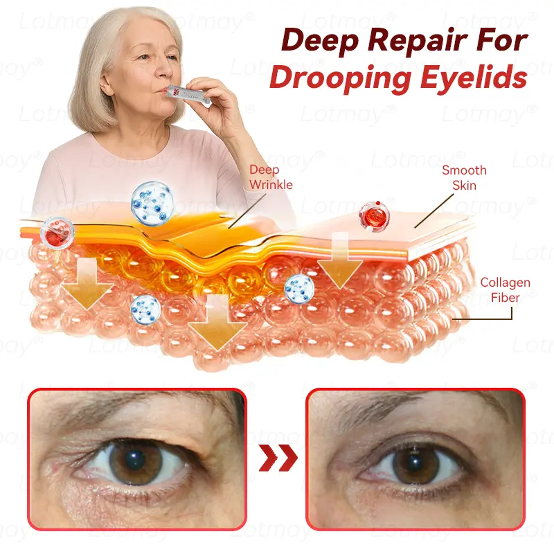 ๐ก๐ ๐ญ N๐ ๐ณ+ ๐ฑ๐๐s๐ F๐๐mi๐g & A๐๐i-๐บ๐๐๐๐ ๐ฎ๐๐l Li๐พ๐๐ถd - Image 9