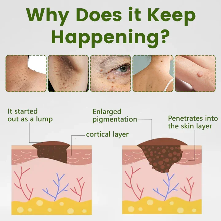 ThujaClear Botanical Wart Cream - Image 2