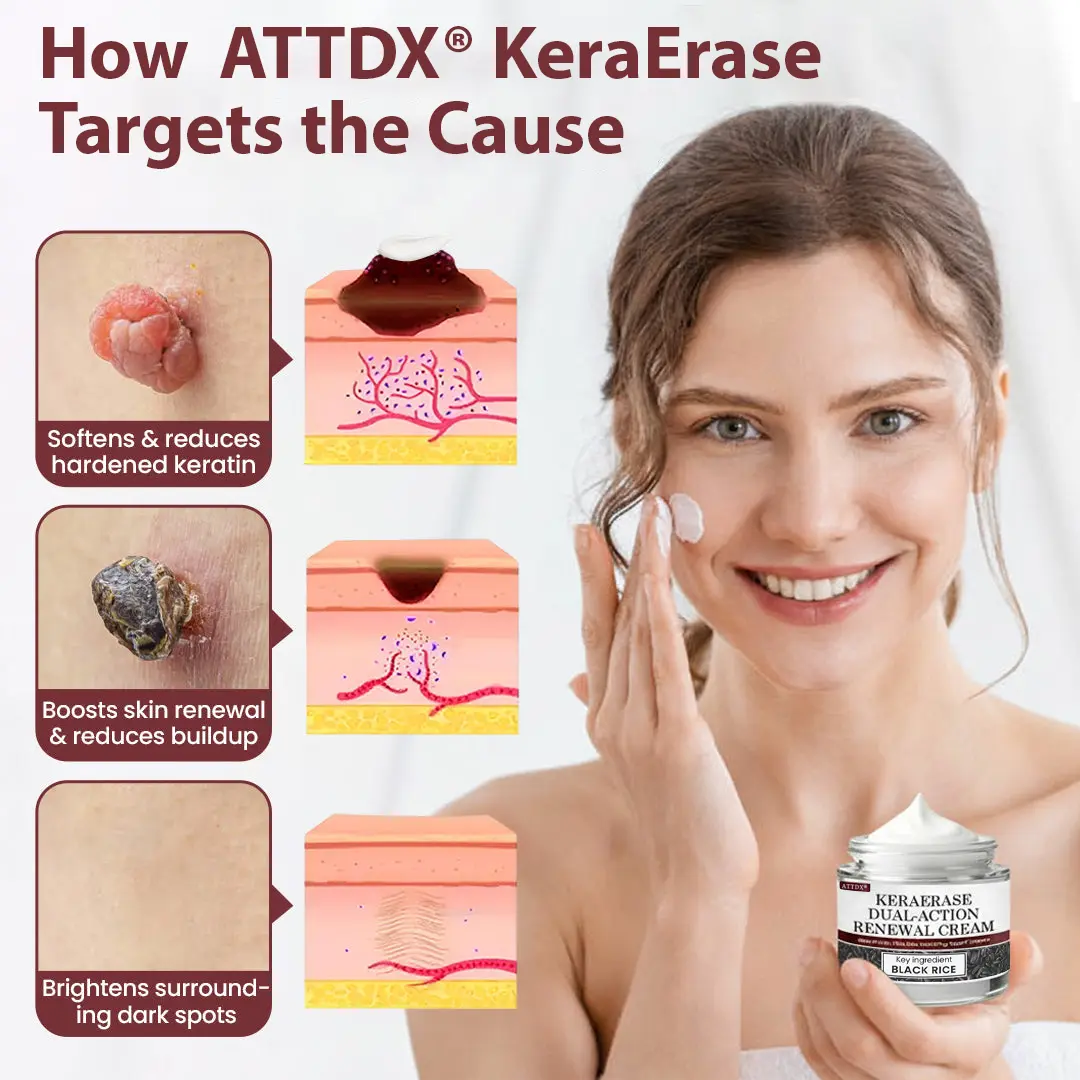 KeraErase Dual-Action Renewal Cream - Image 2