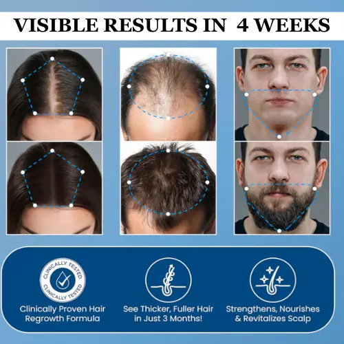 Hair Growth Roll on Serum - Image 2