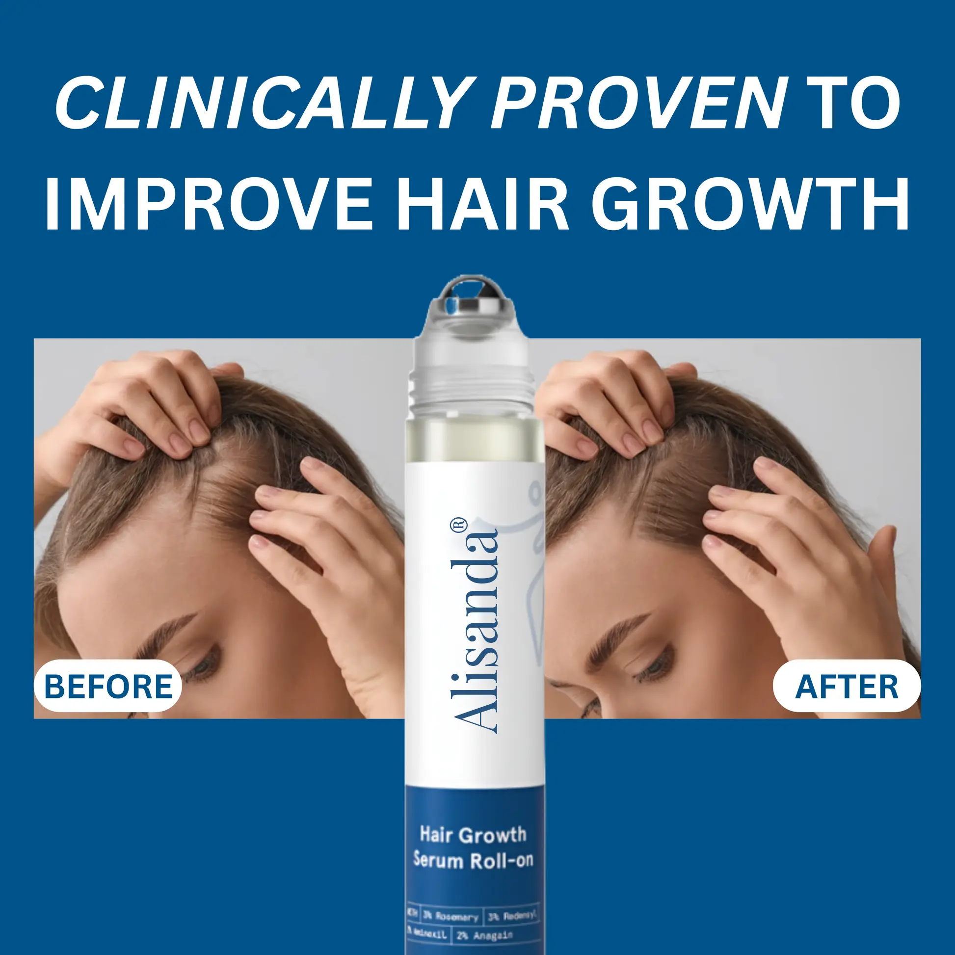 Hair Growth Roll on Serum - Image 5