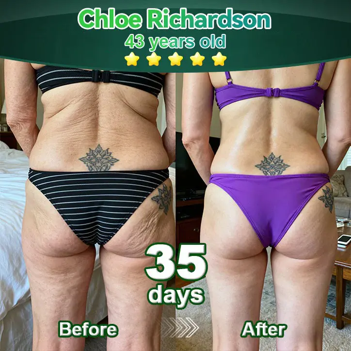 ๐๐ก๐๐ ๐ถ๐๐๐ & ๐ถ๐๐๐๐๐๐๐ ๐๐๐๐ก๐๐๐ ๐๐๐๐ ๐ท๐๐๐๐ - Image 4