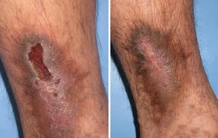 GlucoRelix Diabetes Treatment Softgels - Image 4