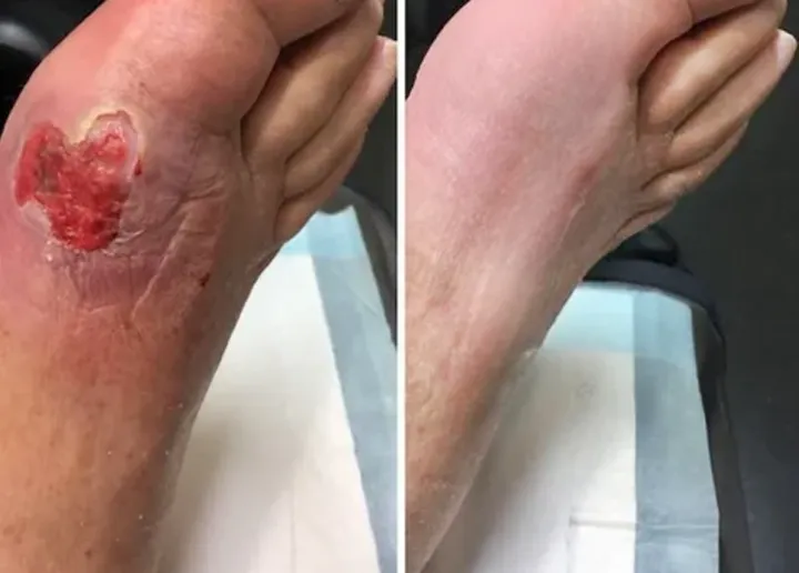 GlucoRelix Diabetes Treatment Softgels - Image 3