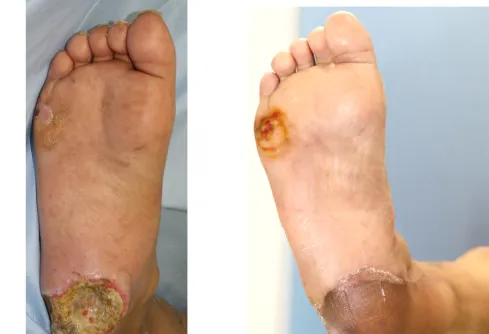 GlucoRelix Diabetes Treatment Softgels - Image 2