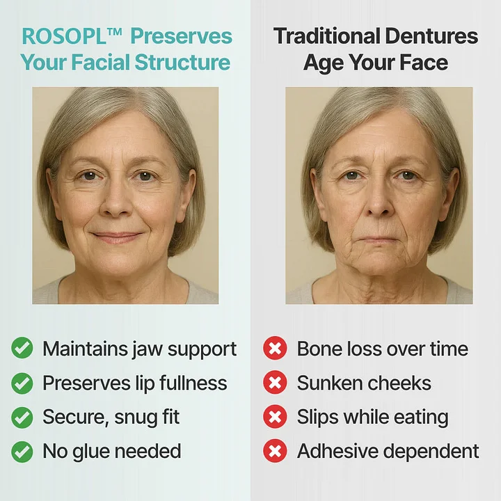 Custom-Fit Dentures - Image 2